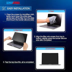 FILMEXT for Macbook Pro16 inch 2019 Removable HD Privacy Screen Protector - Image 6