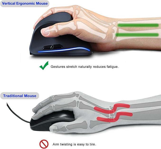 TRELC Ergonomic Mouse, 2.4G Wireless Vertical Optical Mouse - Image 2